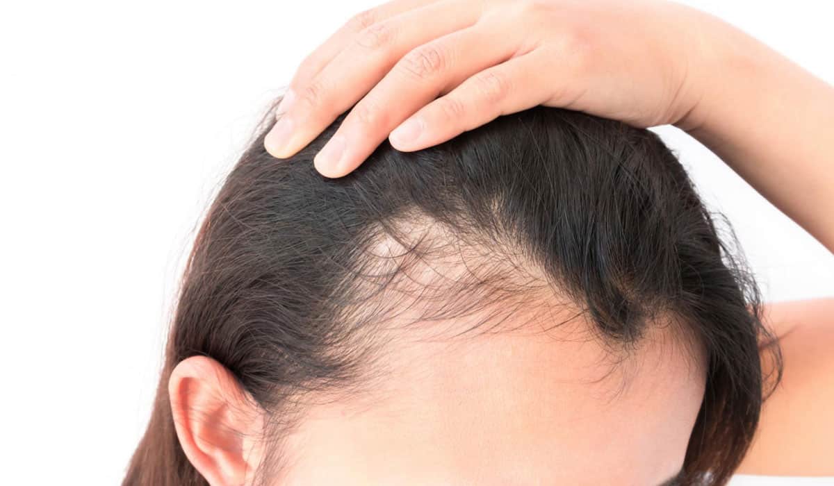خلطات تكثيف الشعر في أسبوع واحد لإطلالة متميزة خلطات تكثيف الشعر في أسبوع واحد لإطلالة متميزة